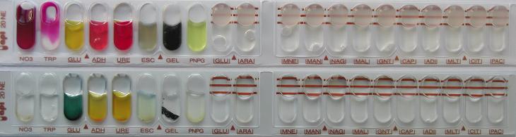 API 20 NE Biomerieux