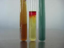 TSI, MIU & Simmons citrate